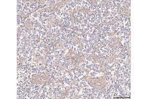 IHC analysis of ANGPT2 using anti-ANGPT2 antibody (ABIN3043725). (Angiopoietin 2 抗体  (AA 19-348))