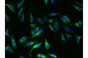 Immunofluorescent analysis of Hela cells using ABIN7172174 at dilution of 1:100 and Alexa Fluor 488-congugated AffiniPure Goat Anti-Rabbit IgG(H+L) (TSH receptor 抗体  (AA 21-413))
