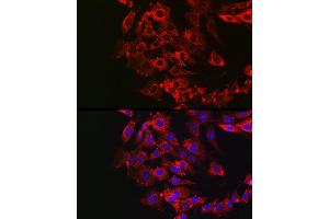 Immunofluorescence analysis of NIH/3T3 cells using GSDME antibody (ABIN6127757, ABIN6139554, ABIN6139555 and ABIN6223304) at dilution of 1:50. (Non-Syndromic Hearing Impairment Protein 5 (GSDME) (AA 1-260) 抗体)