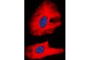 Immunofluorescent analysis of RET (pY1062) staining in K562 cells. (Ret Proto-Oncogene 抗体  (C-Term, pTyr1062))