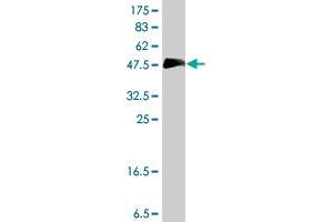 Western Blot detection against Immunogen (37 KDa) . (HOXC10 抗体  (AA 158-257))
