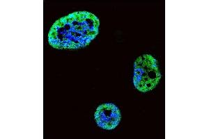 Confocal immunofluorescent analysis of HDGF Antibody (C-term) (ABIN390356 and ABIN2840767) with SK-BR-3 cell followed by Alexa Fluor 488-conjugated goat anti-rabbit lgG (green). (HDGF 抗体  (C-Term))