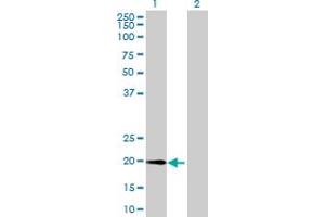 Western Blot analysis of METTL10 expression in transfected 293T cell line by METTL10 MaxPab polyclonal antibody. (METTL10 抗体  (AA 1-192))