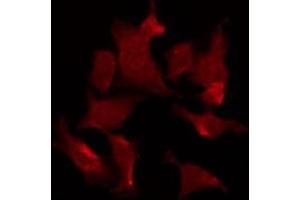 ABIN6275671 staining HT29 by IF/ICC. (Vangl1 抗体  (Internal Region))