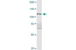 DIS3L MaxPab polyclonal antibody. (DIS3L 抗体  (AA 1-971))