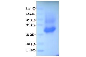 SDS-PAGE (SDS) image for Elastase, Neutrophil Expressed (ELANE) (AA 30-267) protein (His tag) (ABIN5713426) (ELANE Protein (AA 30-267) (His tag))