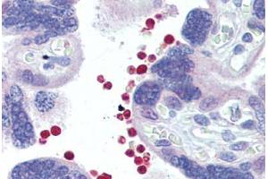 Placenta, red blood cells, Human: Formalin-Fixed, Paraffin-Embedded (FFPE) (AKT1/2 抗体)