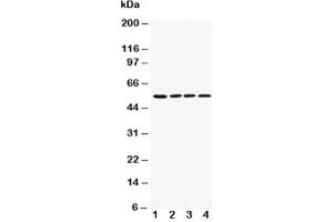 Western blot testing of AChR antibody and Lane 1:  rat brain;  2: mouse brain;  3: U87;  4: SHG-44;  5: Neuro-2a;  6: HeLa cell lysate (CHRM1 抗体  (AA 303-317))