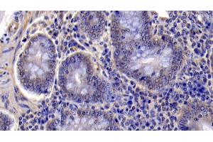 Detection of CASP6 in Bovine Colon Tissue using Polyclonal Antibody to Caspase 6 (CASP6)