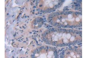 Immunohistochemistry (IHC) image for anti-Interleukin 12 alpha (IL12A) (AA 23-215) antibody (ABIN7430657)
