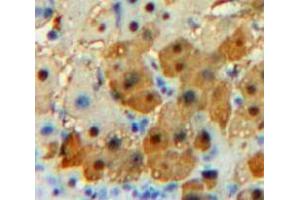 Used in DAB staining on fromalin fixed paraffin-embedded Liver tissue (CPE 抗体  (AA 151-317))