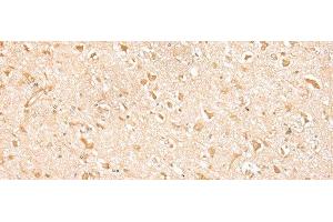 Immunohistochemistry of paraffin-embedded Human brain tissue using MED6 Polyclonal Antibody at dilution of 1:30(x200) (MED6 抗体)