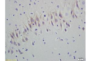 Formalin-fixed and paraffin embedded rat brain labeled with Anti-RGS5 Polyclonal Antibody, Unconjugated (ABIN680803) at 1:200 followed by conjugation to the secondary antibody and DAB staining (RGS5 抗体  (AA 81-181))