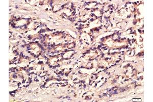 Immunohistochemistry (Paraffin-embedded Sections) (IHC (p)) image for anti-Interleukin 12 (IL12) (AA 51-150) antibody (ABIN734453)