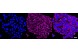 Immunocytochemical staining of HepG2 cells with Bcl10 antibody (ABIN7797717), 1:1,000). (Recombinant BCL10 抗体)