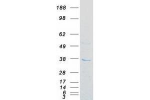 Validation with Western Blot