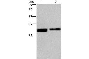 Western Blot analysis of Hela and Jurkat cell using FOSL1 Polyclonal Antibody at dilution of 1:615 (FOSL1 抗体)