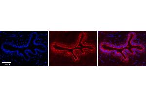 Immunohistochemistry (IHC) image for anti-Chaperonin Containing TCP1, Subunit 4 (Delta) (CCT4) (C-Term) antibody (ABIN2775694)