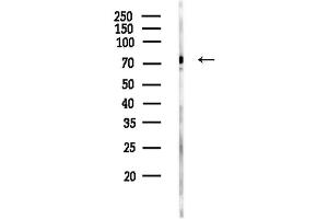anti-Folliculin (FLCN) (N-Term) antibody