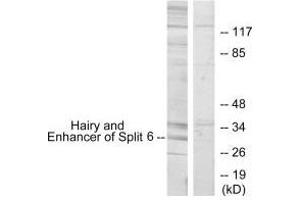 Western blot analysis of extracts from HeLa cells, using HES6 antibody. (HES6 抗体  (N-Term))