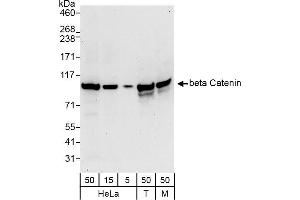 Western Blotting (WB) image for anti-Catenin, beta (CATNB) (AA 25-75) antibody (ABIN7453663) (beta Catenin 抗体  (AA 25-75))