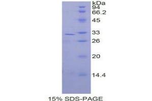 SDS-PAGE analysis of Human MAP2K3 Protein. (MAP2K3 蛋白)