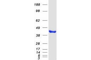 Western Blotting (WB) image for Eukaryotic Translation Initiation Factor 3, Subunit M (EIF3M) protein (Myc-DYKDDDDK Tag) (ABIN2728407)