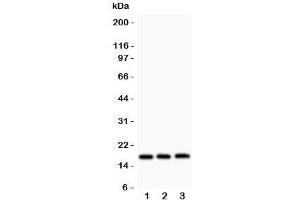Western blot testing of FHIT antibody and Lane 1:  HT1080;  2: SW620;  3: Jurkat. (FHIT 抗体  (AA 1-147))