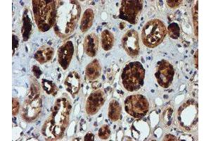 Immunohistochemical staining of paraffin-embedded Human Kidney tissue using anti-NQO2 mouse monoclonal antibody. (NQO2 抗体)