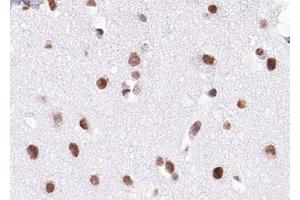ABIN6272938 at 1/100 staining human brain tissue sections by IHC-P. (BRD7 抗体  (Internal Region))