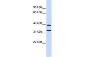 Image no. 1 for anti-Zinc Finger Protein 177 (ZNF177) (C-Term) antibody (ABIN6742763) (ZNF177 抗体  (C-Term))