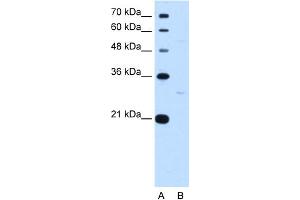 WB Suggested Anti-TEF Antibody Titration:  0. (TEF 抗体  (N-Term))