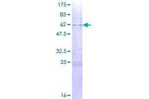 ST6GALNAC4 Protein (AA 1-302) (GST tag)