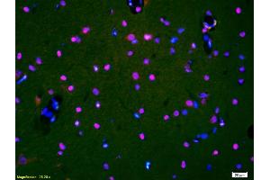 Formalin-fixed and paraffin-embedded rat brain labeled with Anti-HDAC3/HD3 Polyclonal Antibody, Unconjugated (ABIN734903) 1:200, overnight at 4 °C, The secondary antibody was Goat Anti-Rabbit IgG, Cy3 conjugated used at 1:200 dilution for 40 minutes at 37 °C and DAPI staining. (HDAC3 抗体)