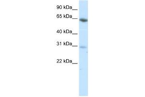 WB Suggested Anti-ZNF195 Antibody Titration:  0. (ZNF195 抗体  (N-Term))