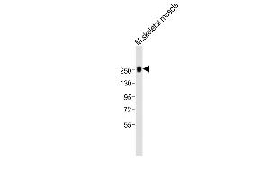 Anti-MYH1 Antibody (N-term)at 1:2000 dilution + mouse skeletal muscle lysates Lysates/proteins at 20 μg per lane. (MYH1 抗体  (N-Term))