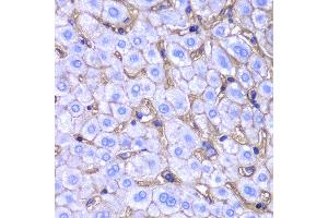Immunohistochemistry (IHC) image for anti-Major Histocompatibility Complex, Class I, A (HLA-A) antibody (ABIN1873024)