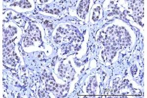 IHC analysis of RBM15B using anti-RBM15B antibody (ABIN7600219). (RBM15B 抗体  (AA 164-890))