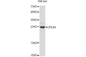 Western blot analysis of extracts of rat eye, using CPLX4 antibody (ABIN6291614) at 1:3000 dilution. (Complexin 4 抗体)