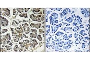 Immunohistochemistry (IHC) image for anti-ATP Synthase, H+ Transporting, Mitochondrial Fo Complex, Subunit C2 (Subunit 9) (ATP5G2) (AA 1-50) antibody (ABIN1534663)