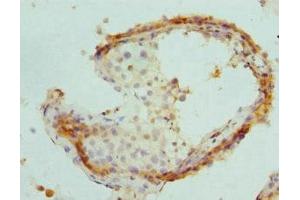Immunohistochemistry (IHC) image for anti-Proteasome (Prosome, Macropain) Activator Subunit 1 (PA28 Alpha) (PSME1) (AA 1-249) antibody (ABIN7164913)