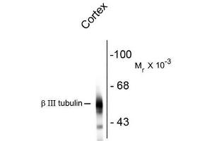 Western Blotting (WB) image for anti-Tubulin, beta 3 (TUBB3) antibody (ABIN371847) (TUBB3 抗体)