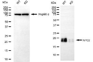 Western blotting analysis using NPC2 antibody (ABIN7799599).