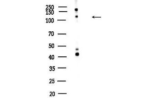 Western blot analysis of lysates from K562 cells, using Phospho-B Raf (Ser446) Antibody at 1/1000 dilution.