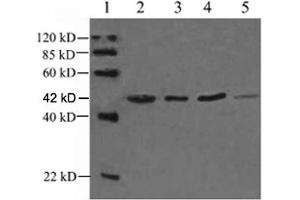 Lane 1: EasyWestern Protein Standard   Lane 2: Rabbit muscular tissue lysateLane 3: Fish tissue lysateLane 4: Hela cell lysateLane 5: Rat brain lysate Primary antibody: 1 µg/mL Rabbit Anti-alpha-Actin-1 Polyclonal Antibody (ABIN398560) The result was developed with One-Step WesternTM Complete Kit (Rabbit) (ABIN491509) (Actin 抗体)