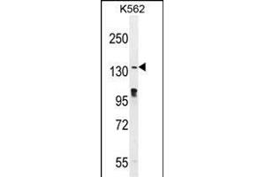 OVOS Antibody (N-term) (ABIN655570 and ABIN2845070) western blot analysis in K562 cell line lysates (35 μg/lane). (OVOS1 (AA 99-128), (N-Term) 抗体)