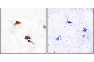 Immunohistochemistry analysis of paraffin-embedded human brain tissue, using PPIF Antibody. (PPIF 抗体  (AA 86-135))