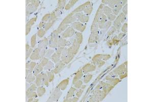 Immunohistochemistry of paraffin-embedded rat heart using C Antibody (ABIN3021738, ABIN3021739, ABIN3021740 and ABIN6215697) at dilution of 1:200 (40x lens). (CA3 抗体  (AA 1-260))
