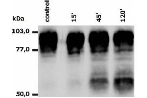 Western Blotting analysis of PMA-activated neutrophils (Fig. (Integrin beta 2 抗体  (PE))