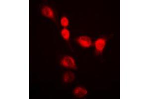 Immunofluorescent analysis of hnRNP A2/B1 staining in HeLa cells. (HNRNPA2B1 抗体  (N-Term))